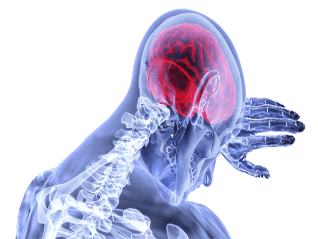 cervicalgia